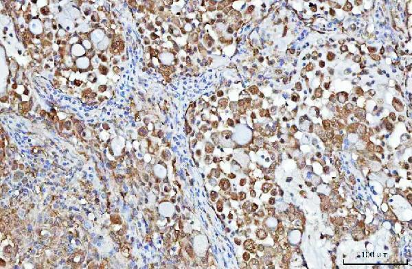  IHC analysis of PGP using anti-PGP antibody (A00932-1)