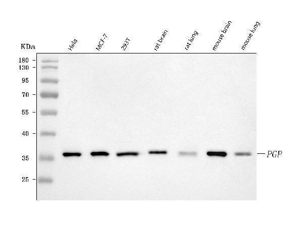  Western blot analysis of PGP using anti-PGP antibody (A00932-1)
