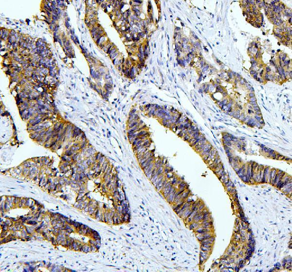 a00933 taz primary antibodies ihc testing 1