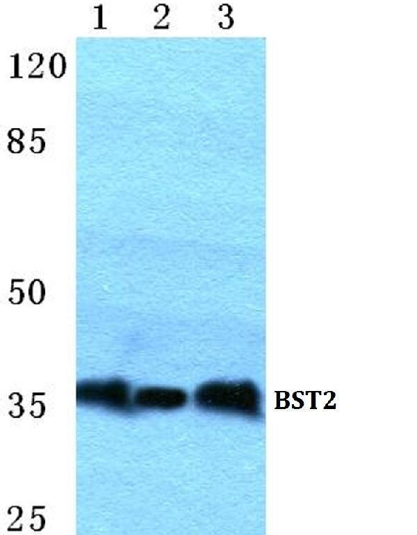 Western blot (WB) analysis of BST2 polyclonal antibody at 1:500 dilution
Lane1:Hela cell lysate
Lane2:Raw264