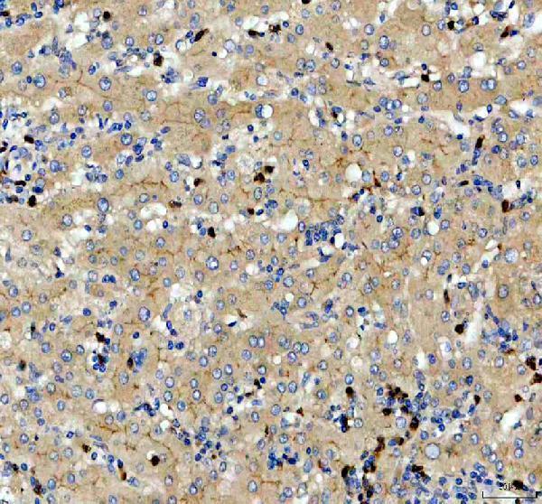 IHC analysis of BST2/Tetherin using anti-BST2/Tetherin antibody (A00934-3)