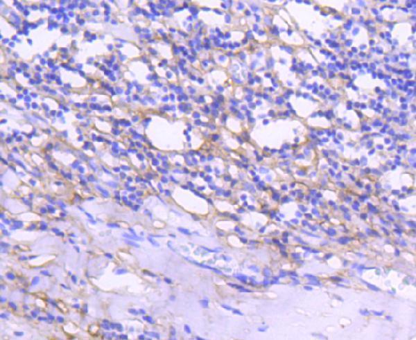 Immunohistochemical analysis of paraffin-embedded human tonsil tissue using anti-Tenascin C antibody