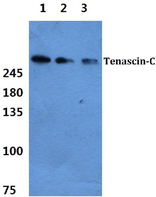 a00936 tnc primary antiboties wb testing 1
