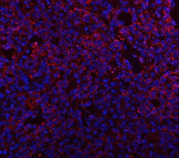 a00937 1 psap primary antibodies if testing 5