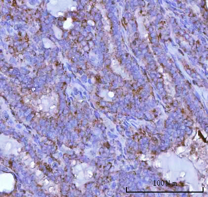  IHC analysis of PSAP using anti-PSAP antibody (A00937-1)