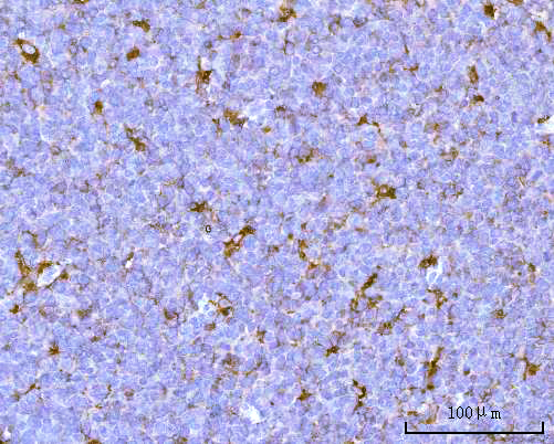  IHC analysis of PSAP using anti-PSAP antibody (A00937-1)