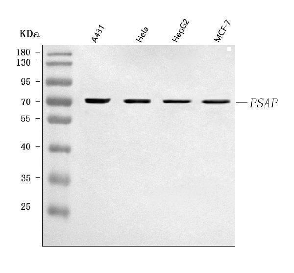  Western blot analysis of PSAP using anti-PSAP antibody (A00937-1)