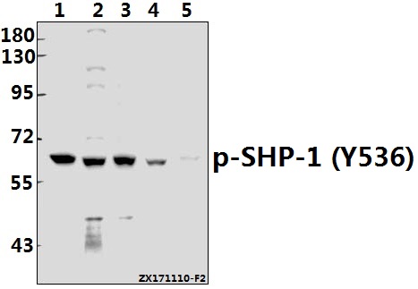 Western blot (WB) analysis of SHP-1 (phospho-Y536) polyclonal antibody at 1:500 dilution
Lane1:MCF-7 whole cell lysate(40ug)
Lane2:H1792 whole cell lysate(40ug)
Lane3:A549 whole cell lysate(40ug)
Lane4:3T3-L1 whole cell lysate(40ug)
Lane5:H9C2 whole cell lysate(40ug)