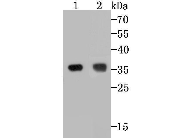 a00940 1 trex1 primary antiboties wb testing 1