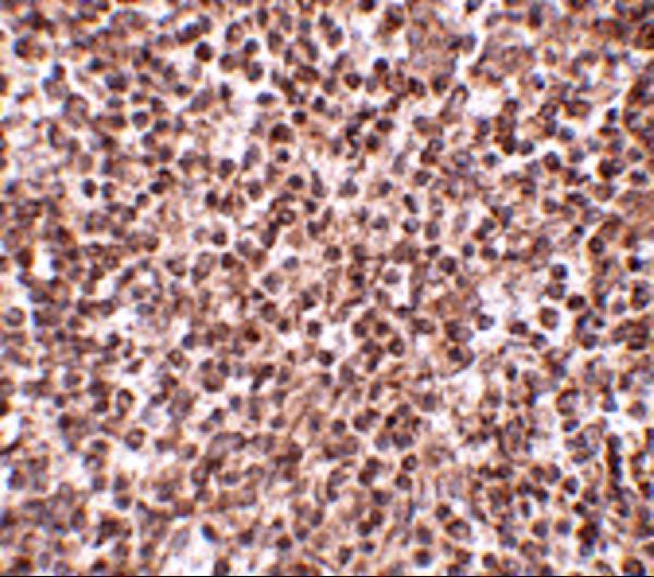 Immunohistochemistry of TREX1 in human spleen tissue with TREX1 antibody at 2