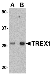 Western blot analysis of TREX1 in human spleen tissue lysate with TREX1 antibody at (A) 0