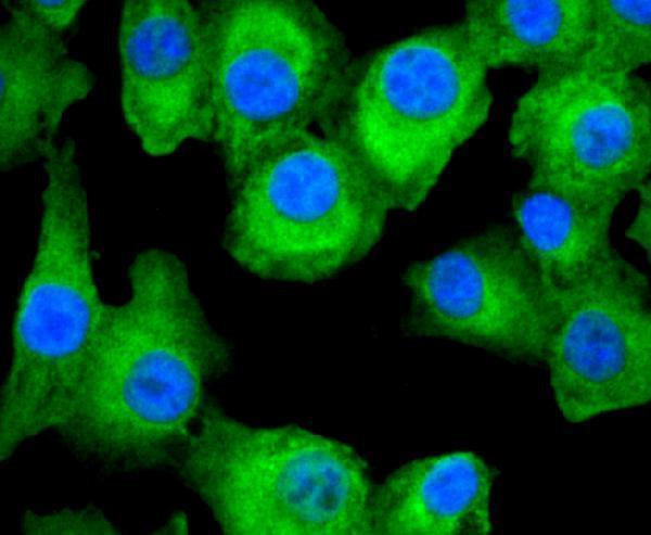 a00941 2 fasn primary antiboties icc testing 1
