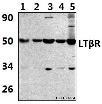 Western blot (WB) analysis of LTβR (R44) polyclonal antibody at 1:500 dilution
Lane1:Hela whole cell lysate(36ug)
Lane2:RAW264