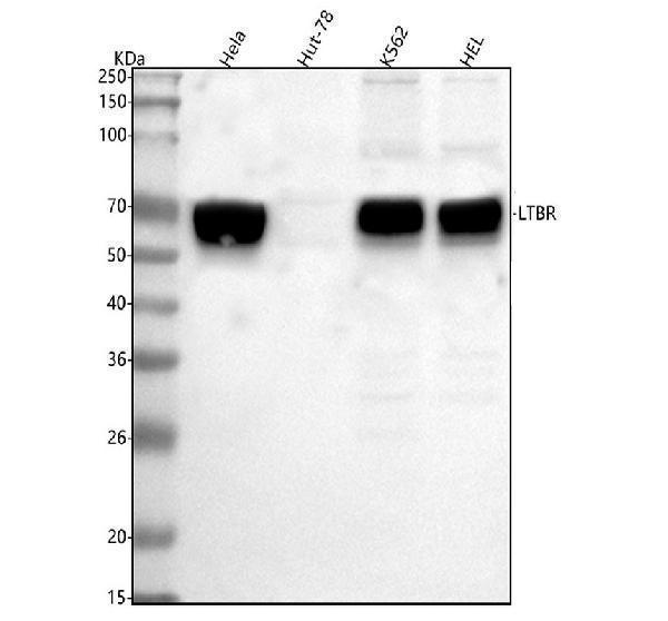  Western blot analysis of LTBR using anti-LTBR antibody (A00942-2)