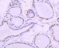 a00943 2 pax8 primary antiboties ihc testing 2