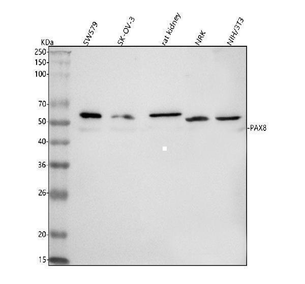  Western blot analysis of PAX8 using anti-PAX8 antibody (A00943-4)