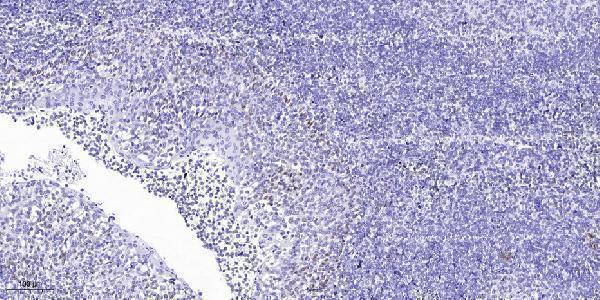 a00944 tal1 primary antibodies ihc testing 1
