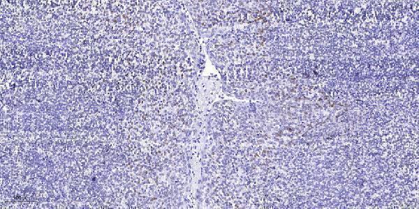 Immunohistochemical analysis of paraffin-embedded human tonsil