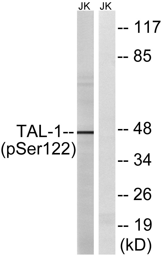 Western blot analysis of lysates from Jurkat cells treated with PMA 125ng/ml 30', using TAL-1 (Phospho-Ser122) Antibody
