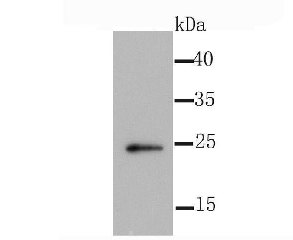 a00945 1 id1 primary antiboties wb testing 1