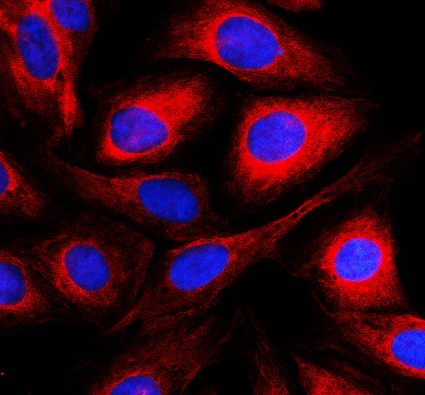 a00948 2 map4 primary antibodies if testing 1