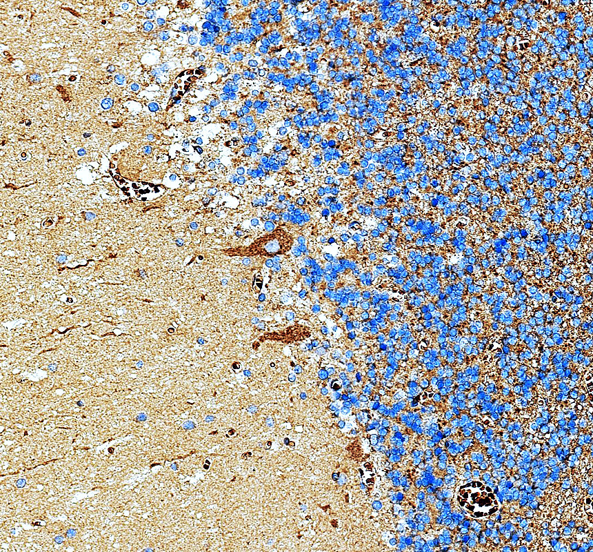 IHC analysis of MAP4 using anti-MAP4 antibody (A00948-2)