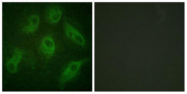a00948 map4 primary antibodies if testing 1