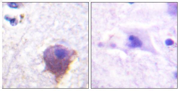 a00948 map4 primary antibodies ihc testing 2
