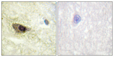 a00948s696 map4 primary antibodies ihc testing 1