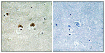 a00948s696 map4 primary antibodies ihc testing 2