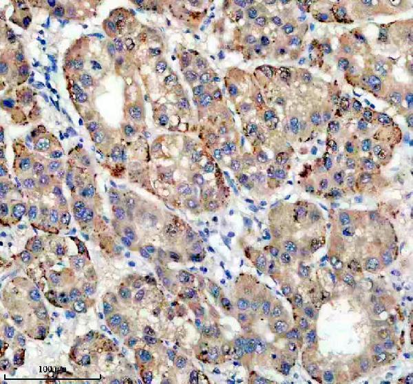 IHC analysis of TIRAP using anti-TIRAP antibody (A00950-1)