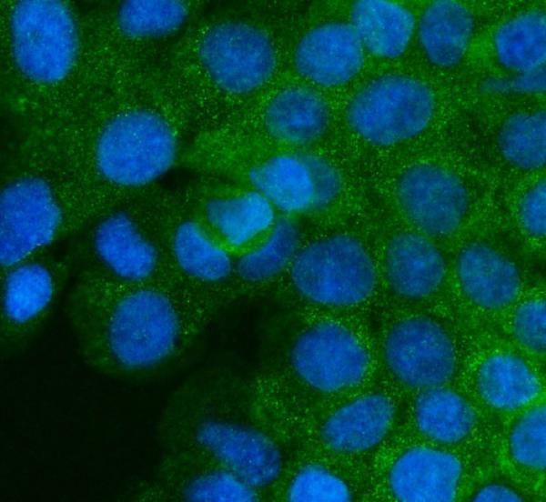 a00951 igf2r primary antibodies if testing 6