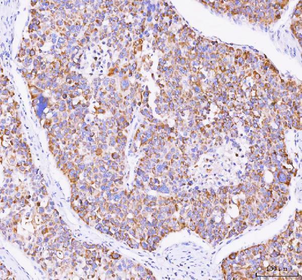 a00951 igf2r primary antibodies ihc testing 3