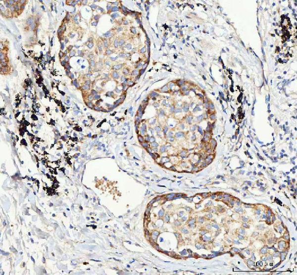 a00951 igf2r primary antibodies ihc testing 4