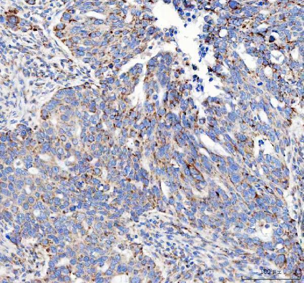 a00951 igf2r primary antibodies ihc testing 5