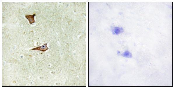 Immunohistochemistry analysis of paraffin-embedded human brain, using IGF2R (Phospho-Ser2409) Antibody