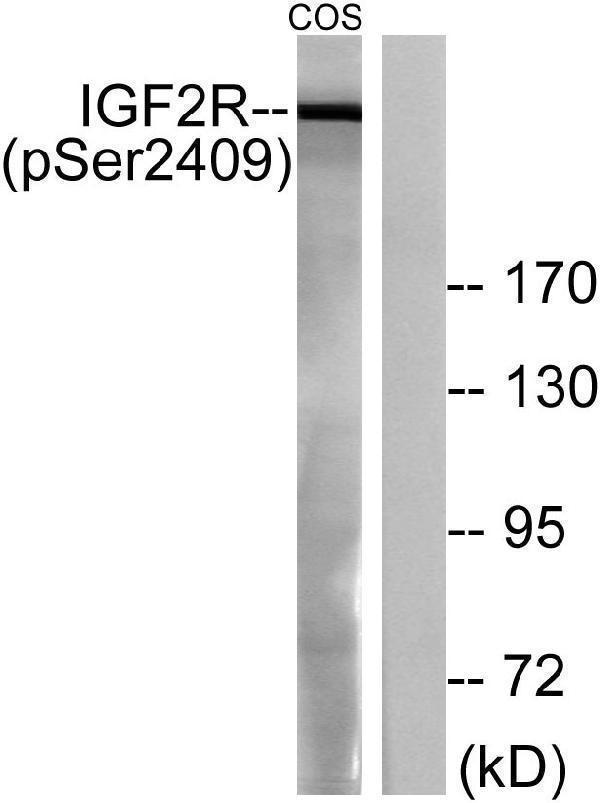 Western blot analysis of lysates from COS7 cells treated with UV 15', using IGF2R (Phospho-Ser2409) Antibody