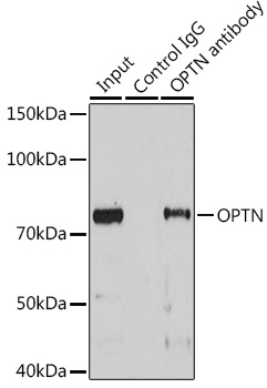 Immunoprecipitation analysis of 25ug extracts of Mouse heart cells using 3ug OPTN antibody 