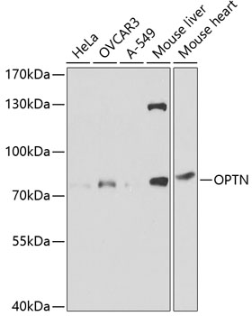 Western blot analysis of extracts of various cell lines, using OPTN antibody  at 1:1000 dilution