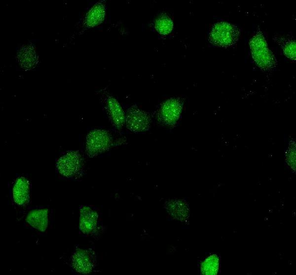 a00953 top2a primary antibodies if testing 1