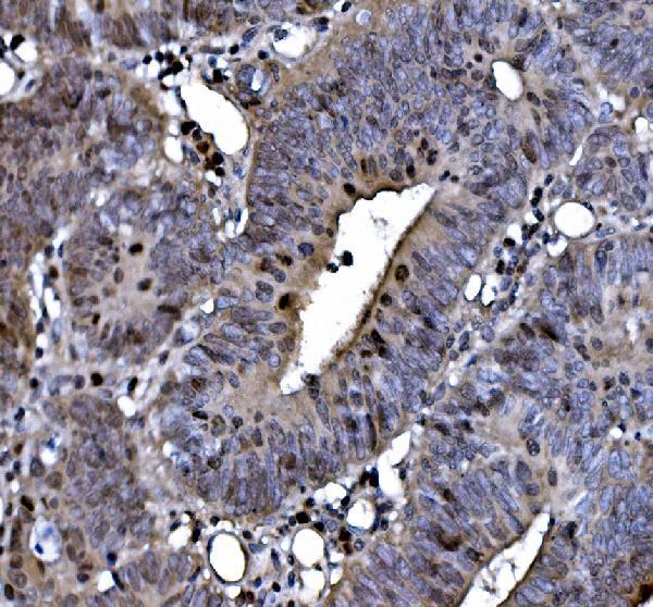 a00953 top2a primary antibodies ihc testing 1