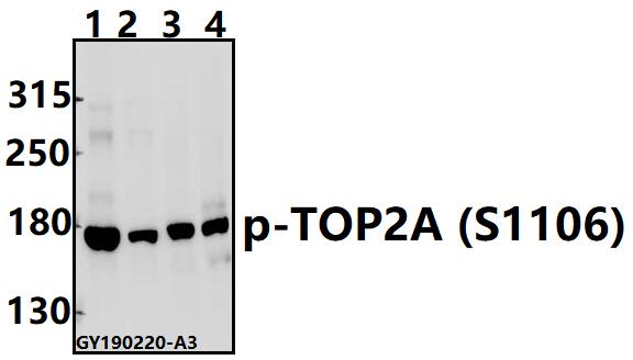 Western blot (WB) analysis of TOP2A (phospho-S1106) polyclonal antibody at 1:500 dilution
Lane1:Myla2059 whole cell lysate(40ug)
Lane2:HuT78 whole cell lysate(40ug)
Lane3:The Testis tissue lysate of Mouse(40ug)
Lane4:The Testis tissue lysate of Rat(40ug)