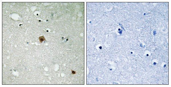Immunohistochemistry analysis of paraffin-embedded human brain, using TOP2A (Phospho-Ser1525) Antibody