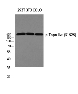 Western blot analysis of 293T 3T3 COLO using p-Topo IIα (S1525) antibody