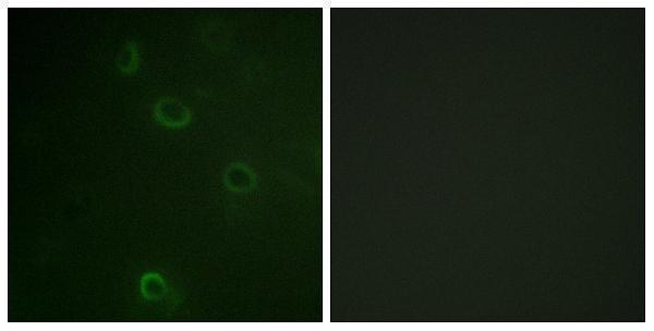 a00956 atp1a1 primary antibodies if testing 1