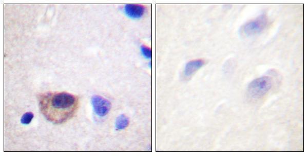 a00956 atp1a1 primary antibodies ihc testing 4