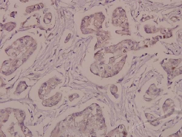 a00956s16 atp1a1 primary antiboties ihc testing 2