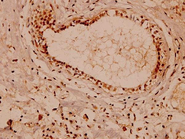 a00956y10 atp1a1 primary antiboties ihc testing 2