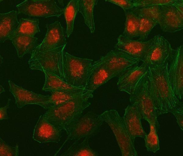 IF analysis of IRF5 using anti-IRF5 antibody (A00958-1)