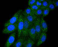 ICC staining IRF5 in HepG2 cells (green)
